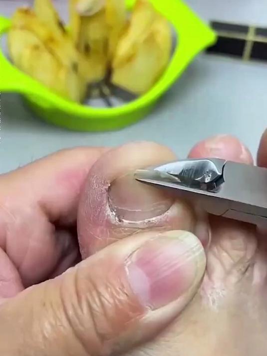 指甲长肉里怎么办?试试这款鹰嘴钳,3秒修剪断,不伤指甲!