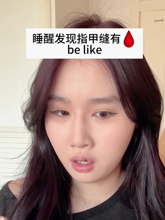 睡醒发现指甲缝有血，谁懂这种感觉