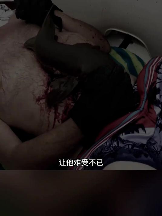 225. 鲨鱼咬住丧彪重要部位上方五厘米,简直难以置信 野生动物?