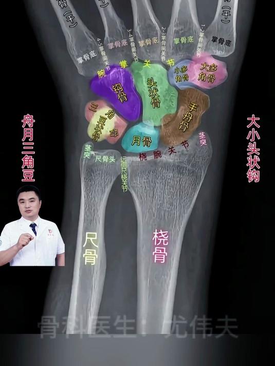 骨科医生眼中的腕关节X线