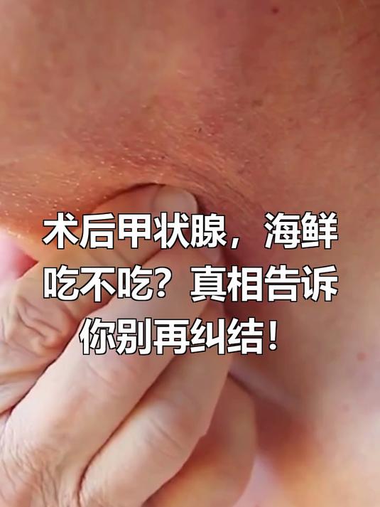 甲状腺手术后能不能吃海鲜