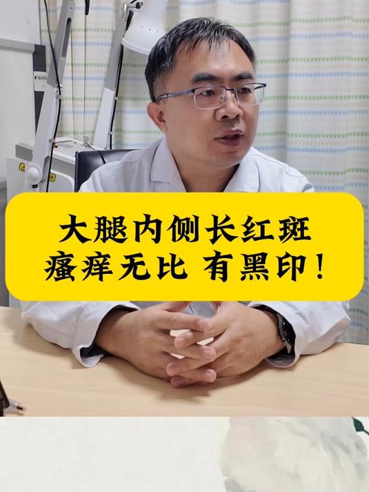 大腿内侧长红斑,瘙痒无比,有黑印!
