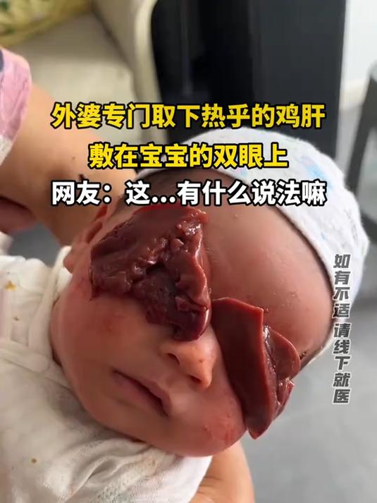 外婆专门取下热乎的鸡肝,敷在宝宝的双眼上