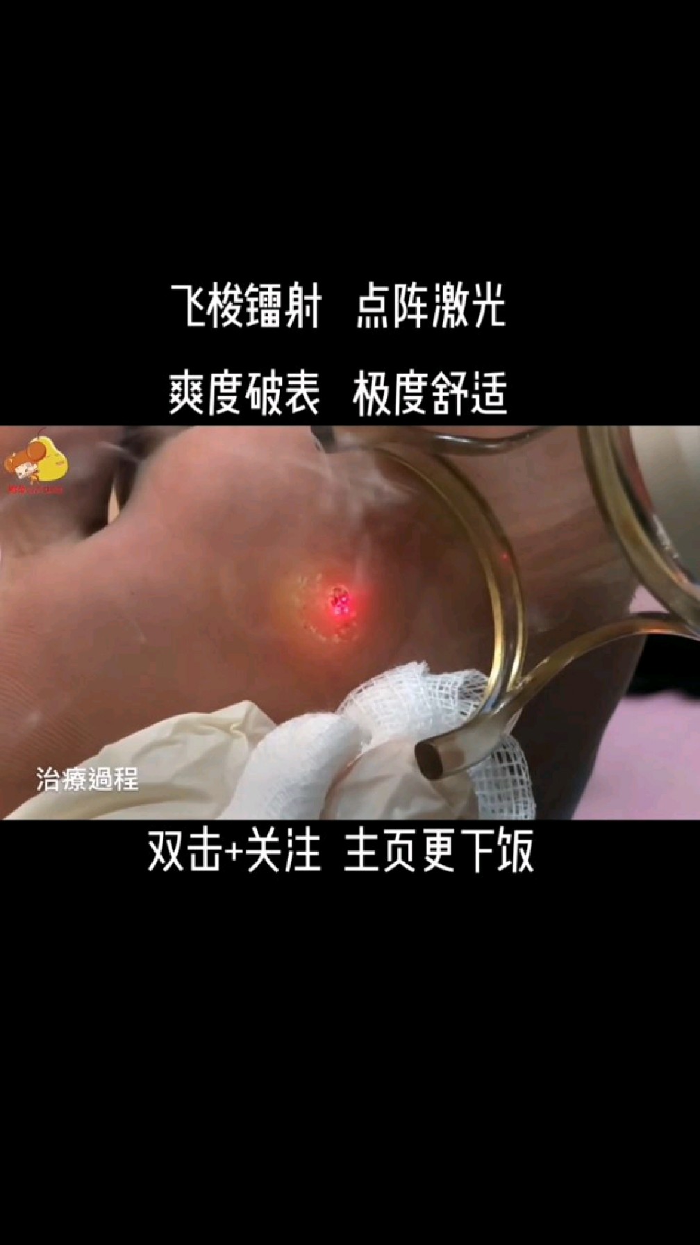 脚底鸡眼到底得罪了谁?为何这么狠心对它?