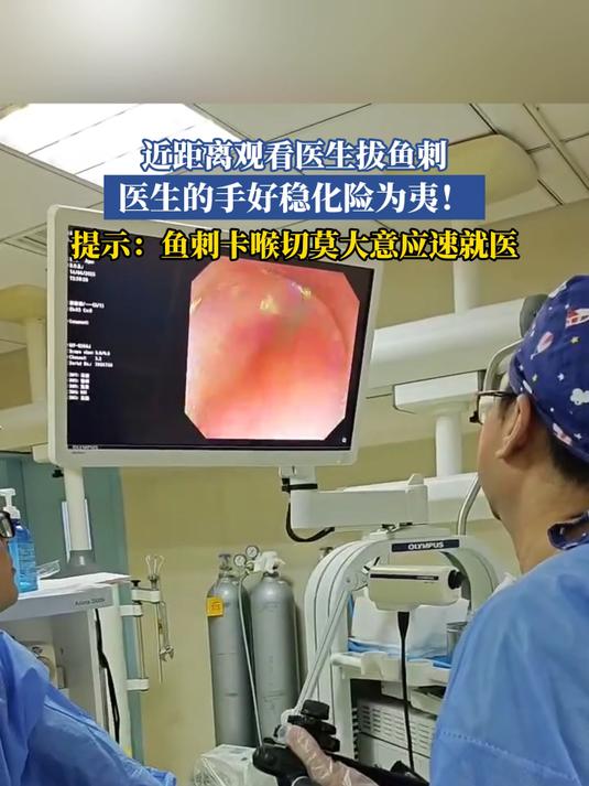 近距离观看医生拔鱼刺,医生的手好稳 化险为夷!
