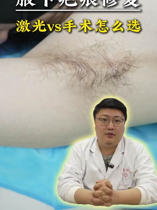 腋下疤痕修复激光vs手术