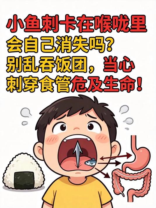 小鱼刺卡在喉咙里会自己消失吗？别乱吞饭团，当心刺穿食管危及生命！