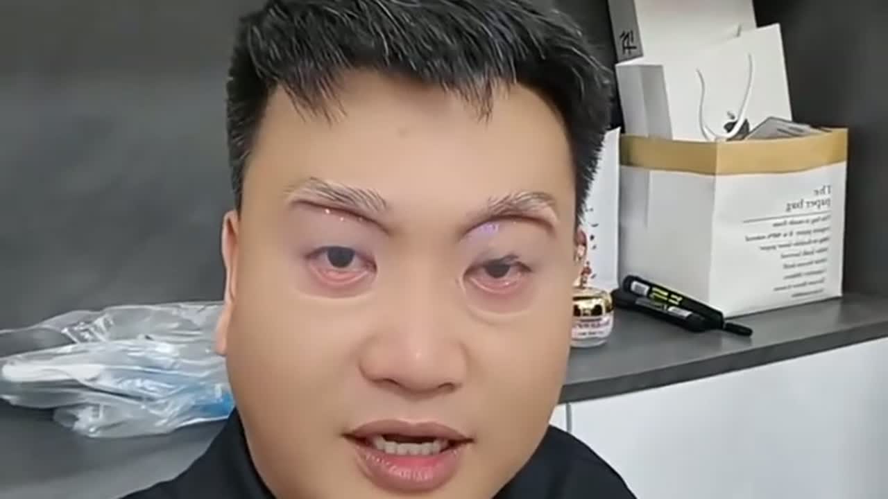 男子的眼太小了经常被人调侃，把眼镜片撑在眼皮上挨了媳妇一巴掌