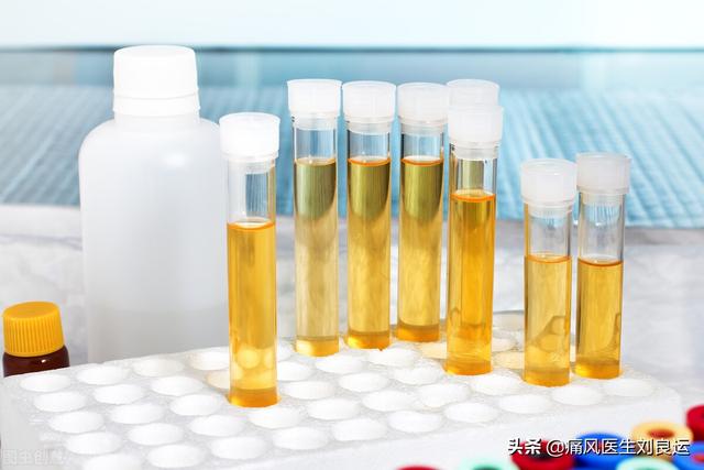 章鱼直播足球即时比分能叛尿酸,我何必要不吃非布司他?碱化尿液并无法治痛风