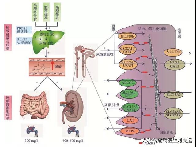 章鱼直播足球即时比分能叛尿酸,我何必要不吃非布司他?碱化尿液并无法治痛风