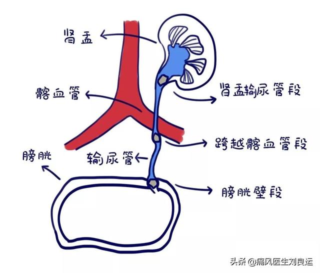 章鱼直播足球即时比分能叛尿酸,我何必要吃非布司他?碱化尿液并不能治痛风