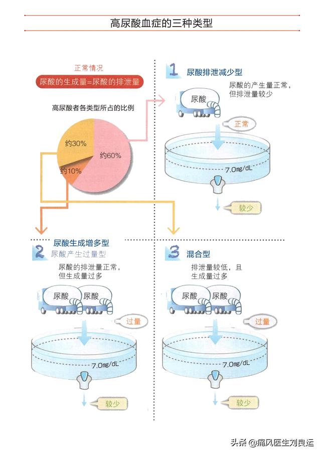 只有胖子才会患痛风？瘦子更容易出现尿酸高，医生讲解个中原因