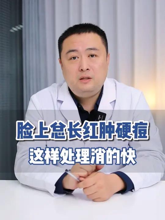 脸上总长红肿硬痘，这样处理消的快！#痘痘 #痤疮 #长痘 #医学科普 #皮肤