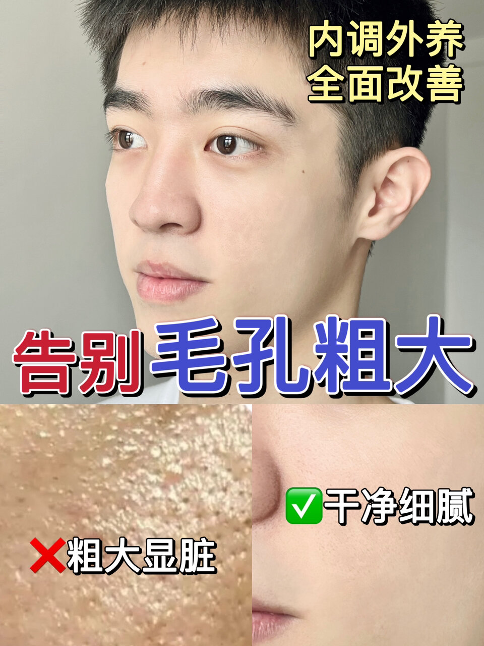 改善毛孔粗大5招轻松搞定手把手教你