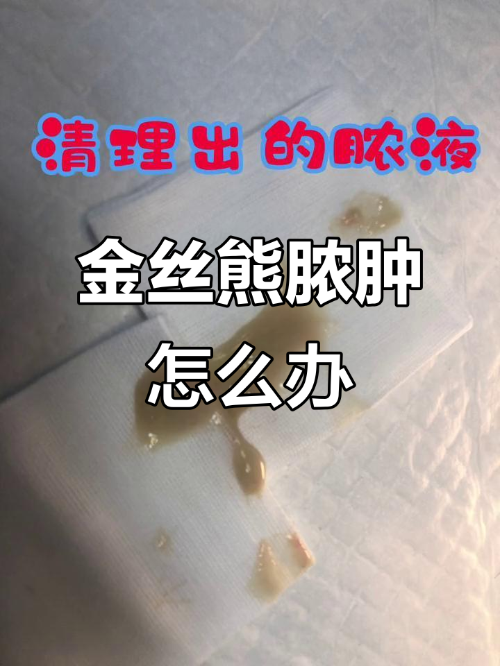 金丝熊脓性囊肿症状与治疗
