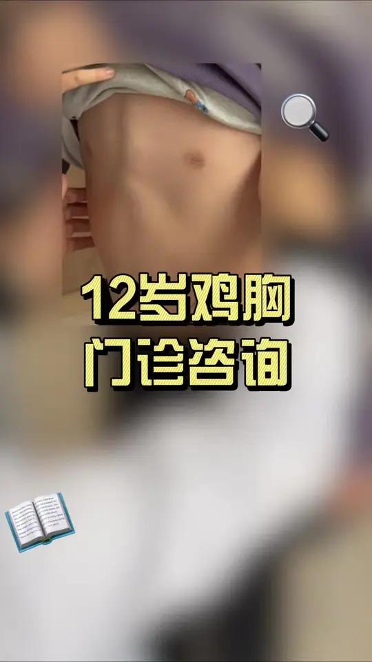 12 岁鸡胸门诊咨询