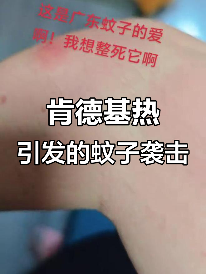 佛山肯德基热,蚊子报复太意外!