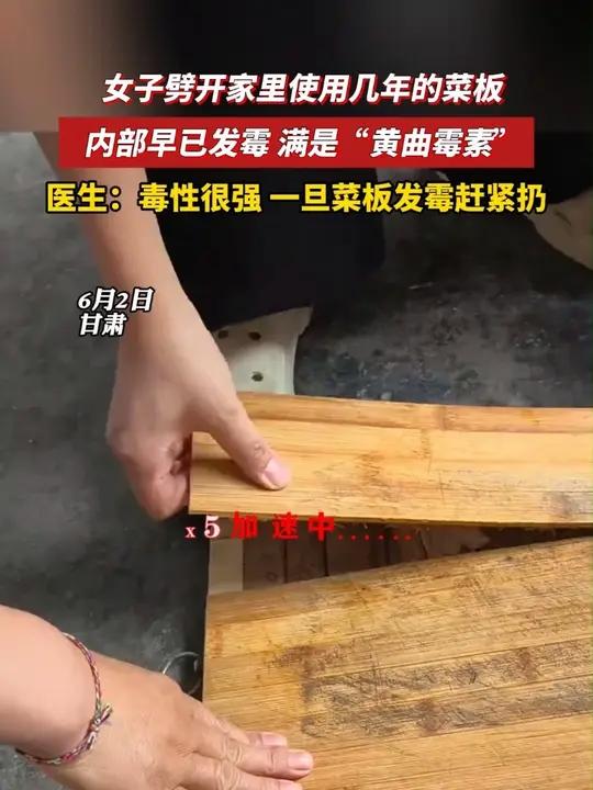 女子劈开家里使用几年的菜板,内部早已发霉满是“黄曲霉素”。医生:毒性很强,一旦菜板发霉赶紧