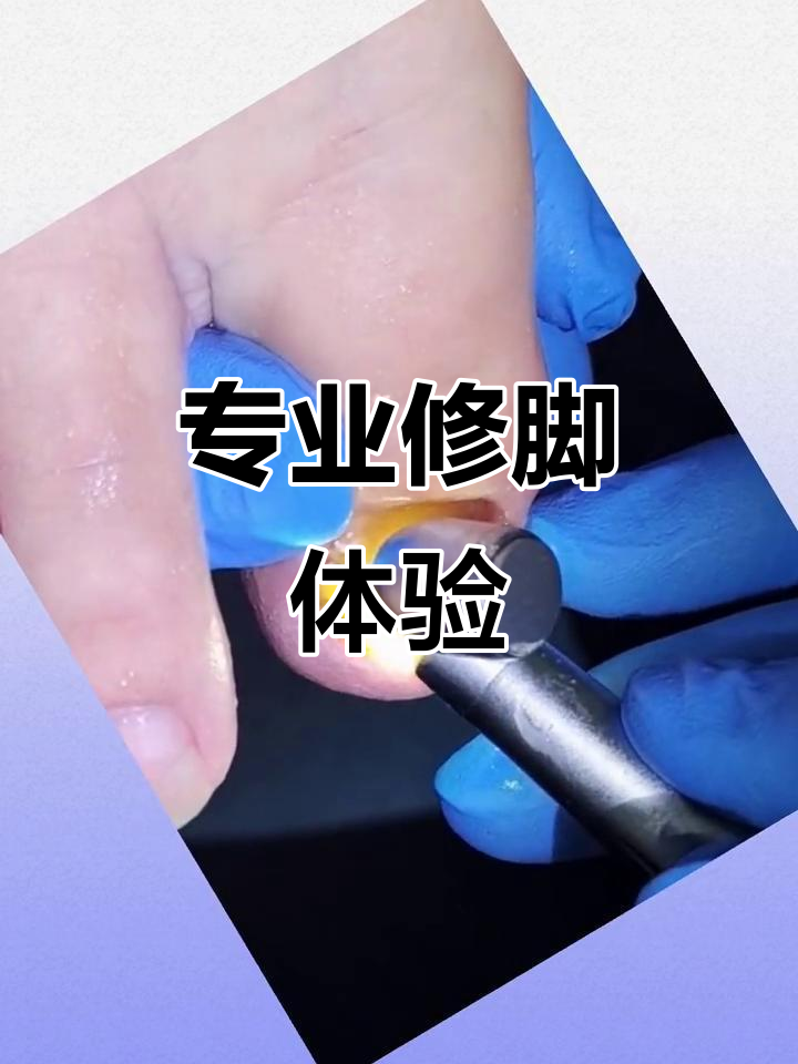修脚过程大揭秘,轻松去除硬指甲和肉刺
