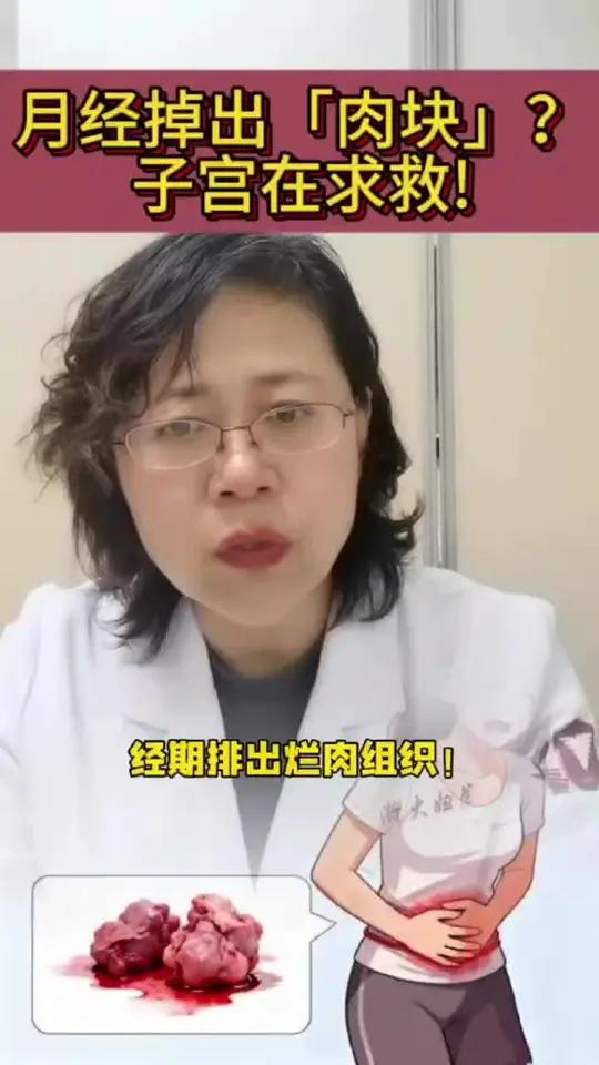 经期排出烂肉粉色火焰传递行动子宫内膜息肉