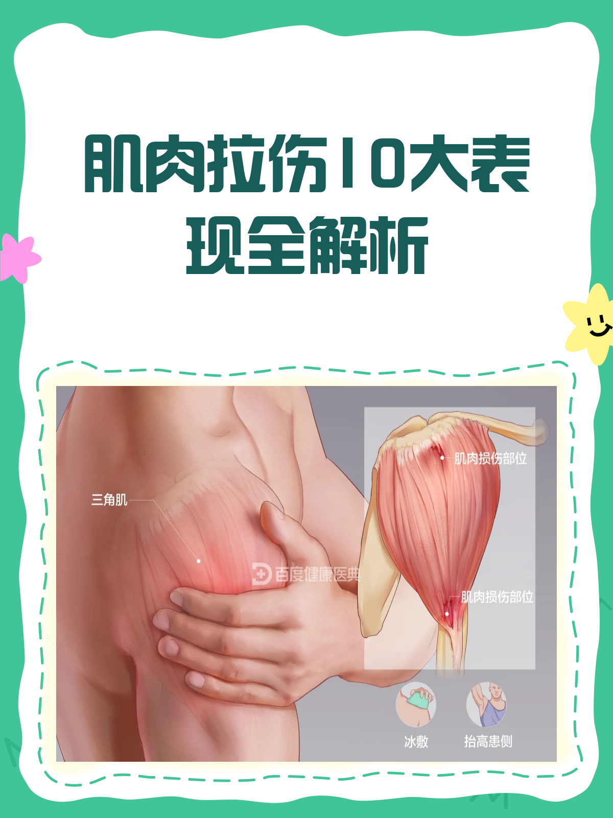 肌肉拉伤的10大表现,你中招了吗?