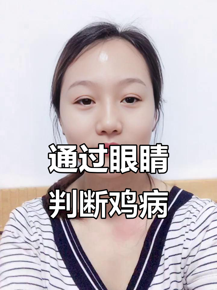 鸡眼变化能揭示疾病，四种常见症状及应对方法