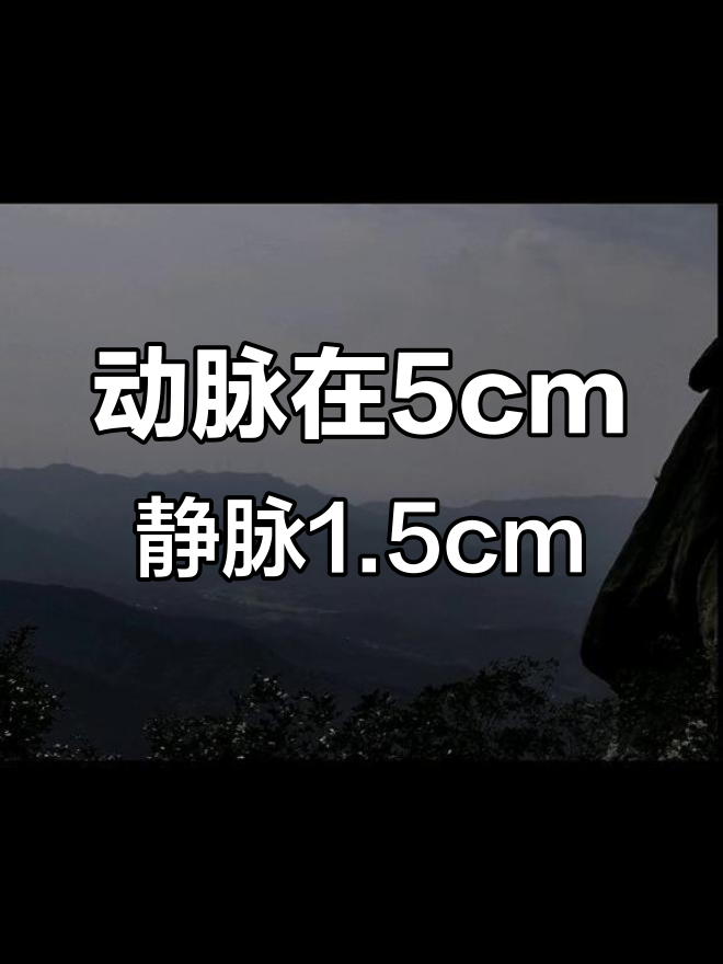 手腕处的动脉与静脉位置