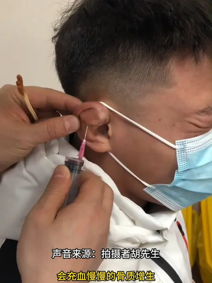 摔跤柔道运动员耳朵是什么样的?“饺子耳”是专属他们的荣誉