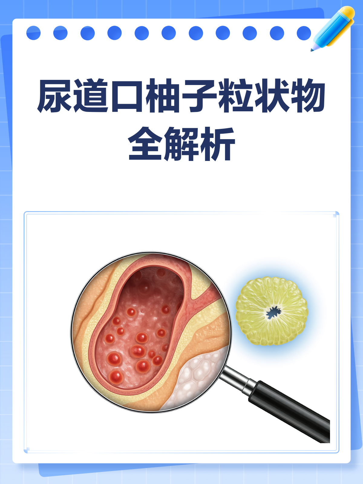 尿道口长柚子粒?别急,一文帮你搞清楚!