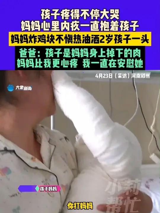 4月23日(采访)河南郑州,孩子疼得不停大哭,妈妈心里内疚一直抱着孩子,妈妈炸鸡块不慎热油