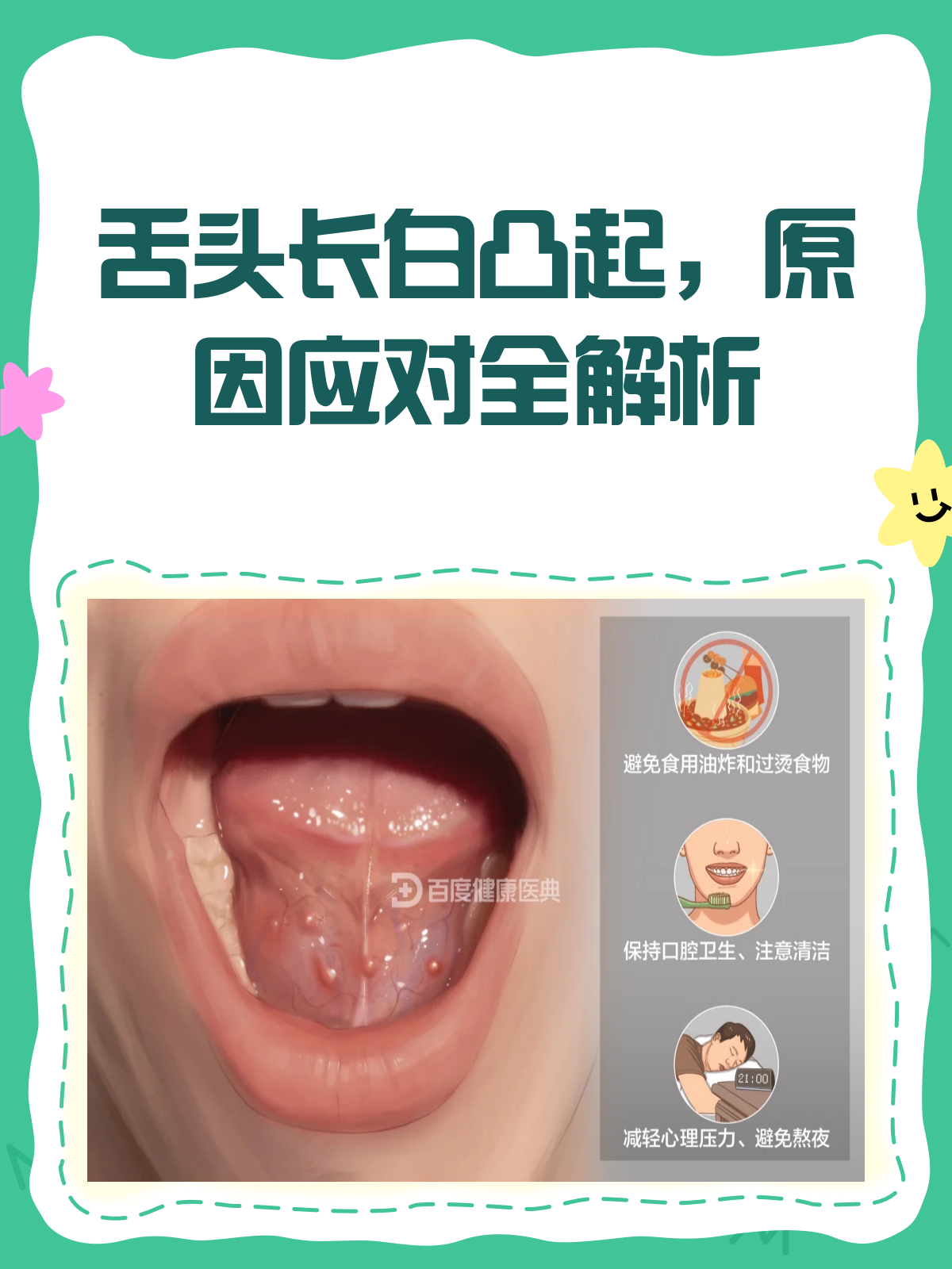舌头上白色凸起物?别急,先看看这篇!