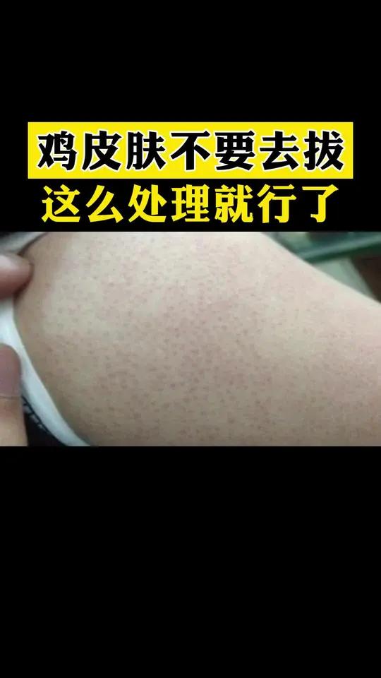 鸡皮肤可不兴这么去拔它,反而会破坏皮肤的屏障医学科普鸡皮肤 毛周角化