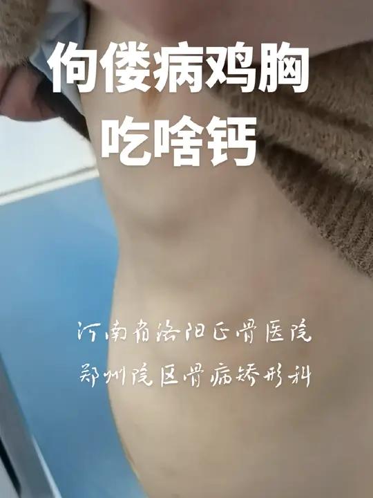 佝偻病鸡胸咋补钙