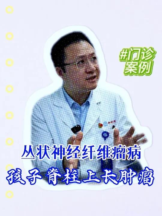 肿瘤导致孩子各种症状,擒贼要先擒王。#神经纤维瘤病 #咖啡牛奶斑 #小儿神经外科赵阳 #儿