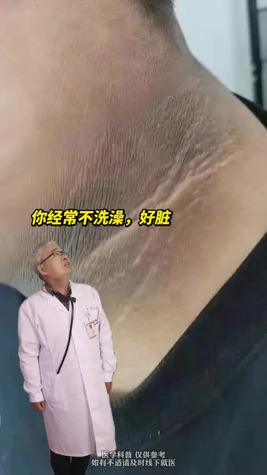 身上你以为的“脏”东西,其实可能是皮肤病.