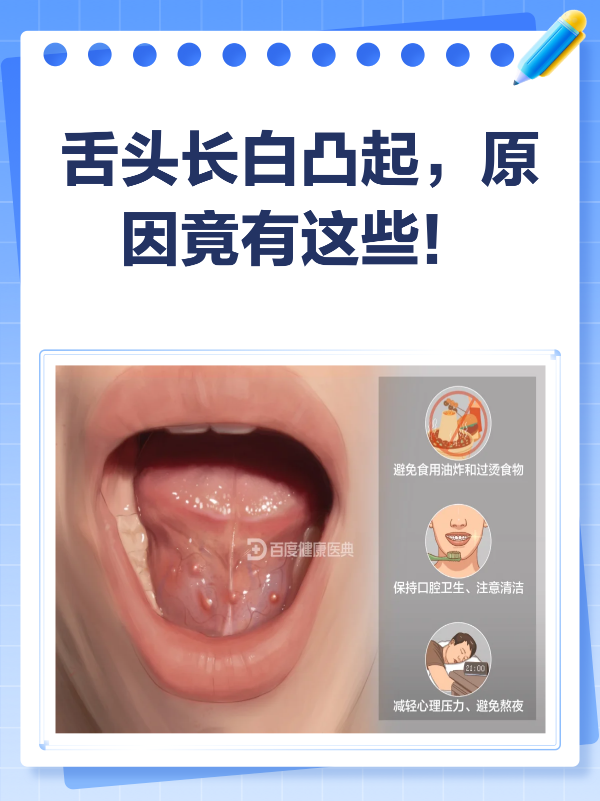 舌头上长了白色凸起?别急,先看看这篇!