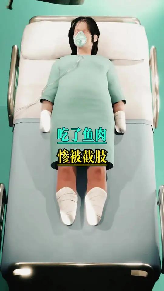 女子吃了鲸鱼肉,导致她需要截肢保命。