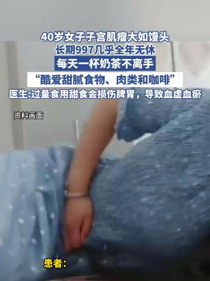 女子每天一杯奶茶子宫肌瘤大如馒头(河南广播电视台)