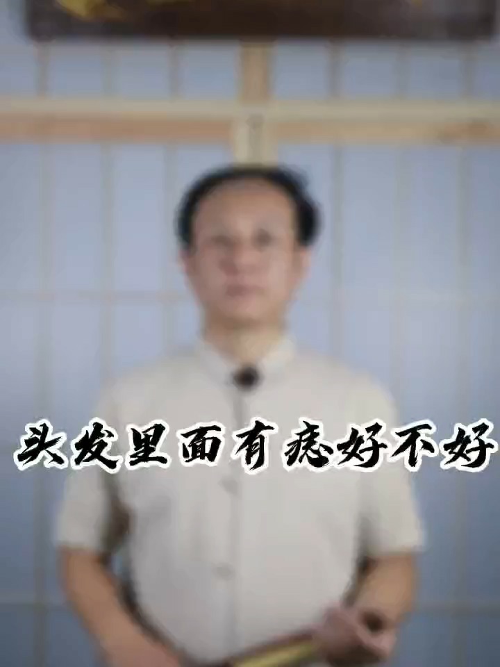 头发里有痣好不好