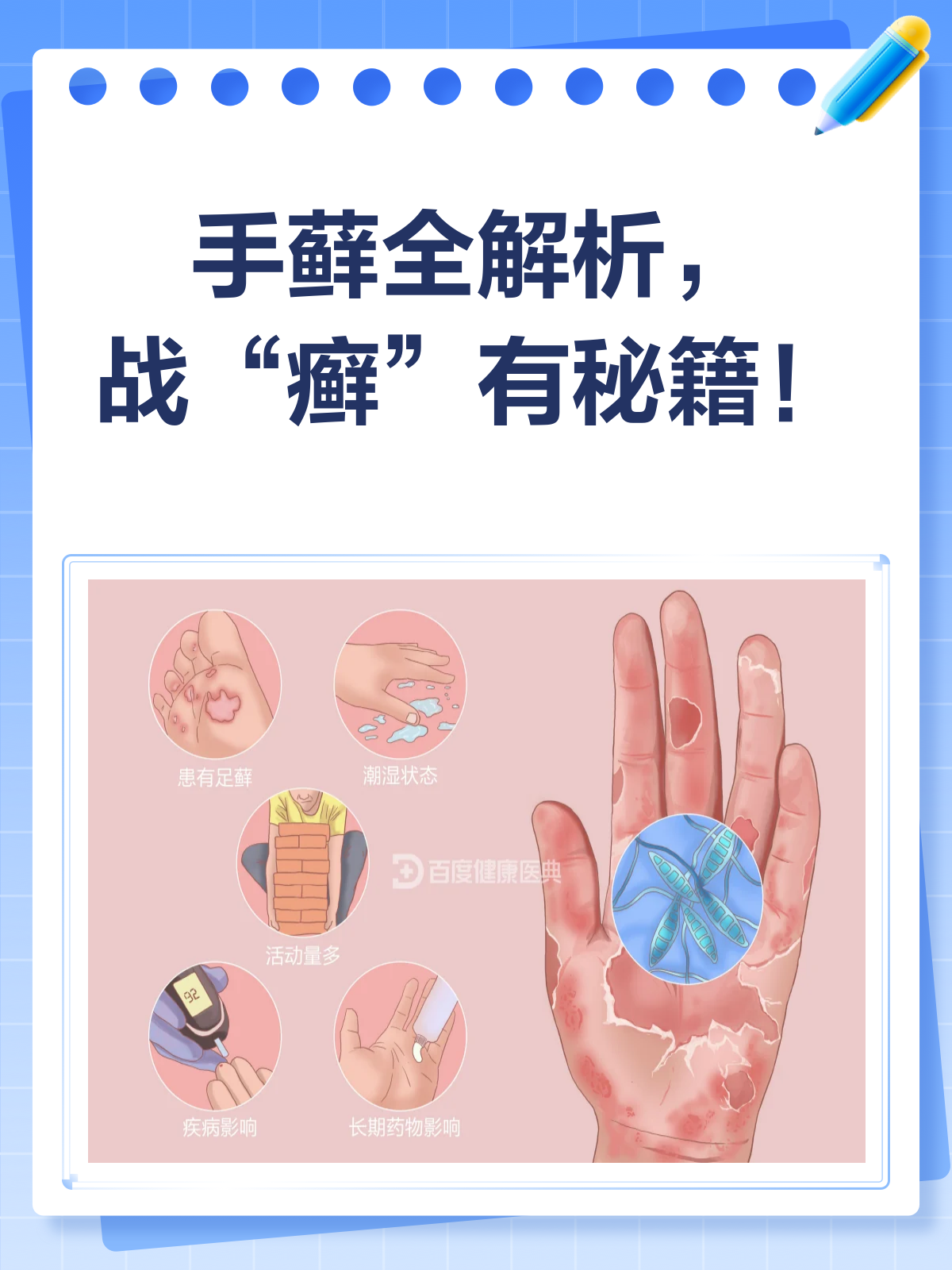 手藓来袭,如何战“癣”到底?