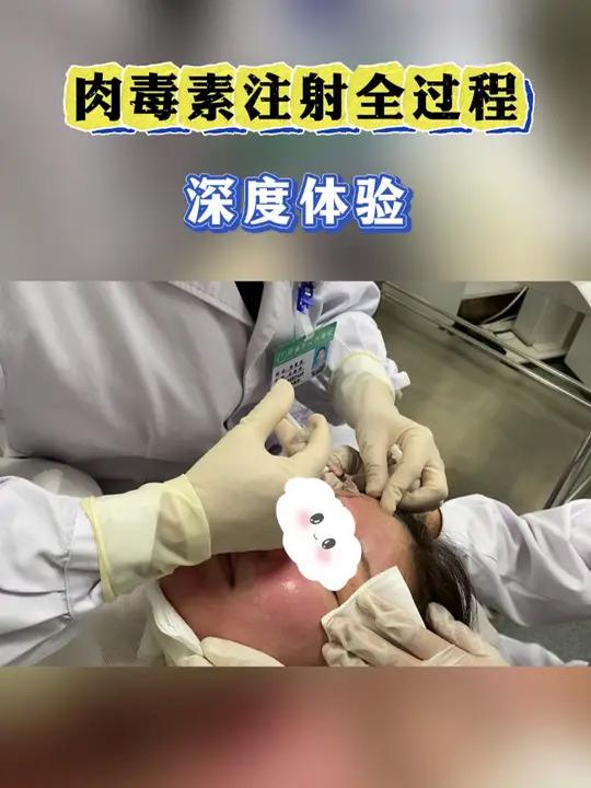 深度体验肉毒素注射全过程 有一种疼叫做看着都疼肉毒皮肤管理抗衰 除皱针