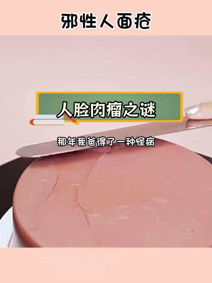 父亲膝盖上的人脸肉瘤