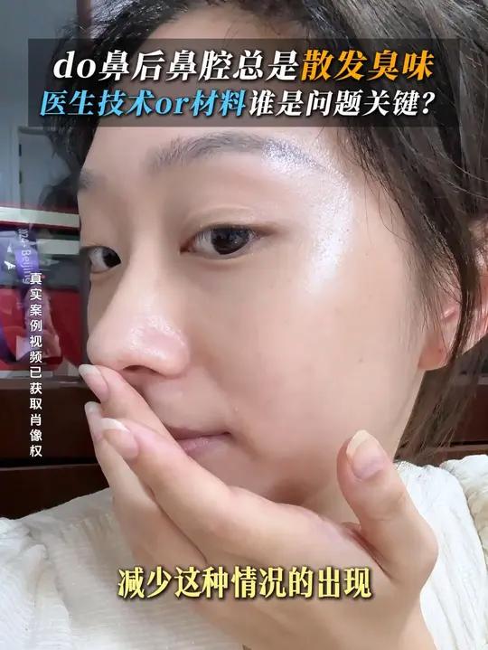 do鼻后鼻腔总是散发臭味,医生技术or材料谁是问题关键