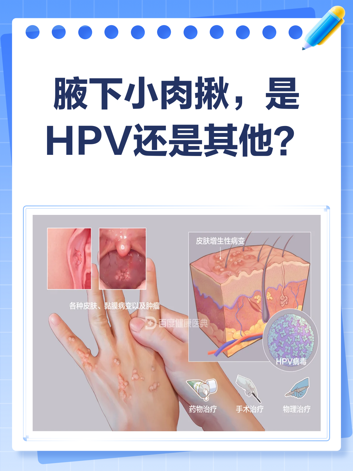 腋下小肉揪,是HPV感染吗?