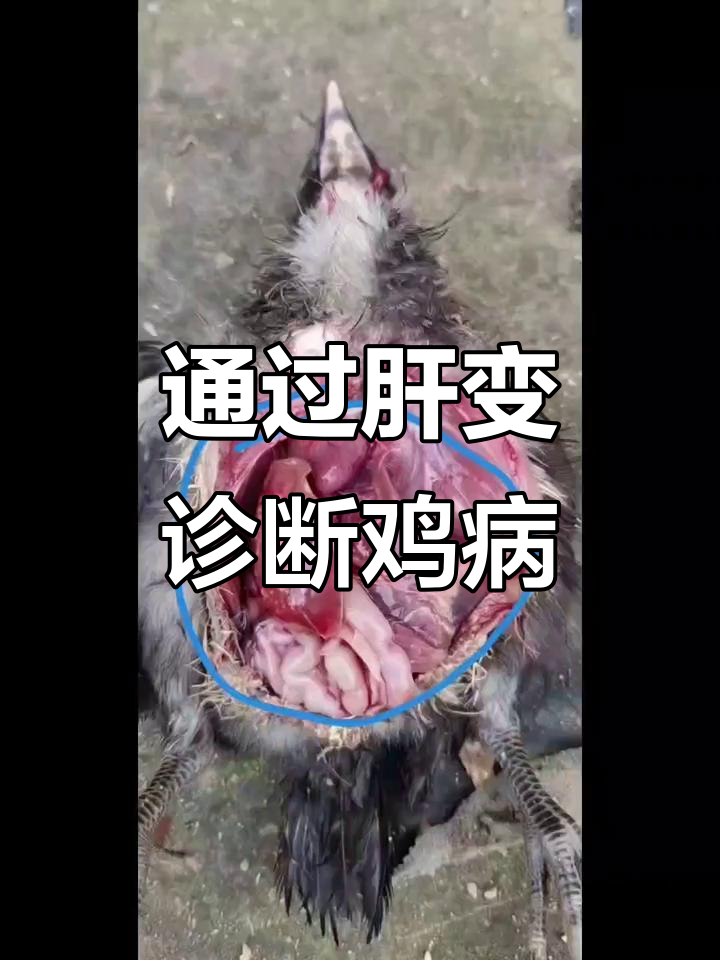 肝脏变化能判断鸡丙,简单又实用