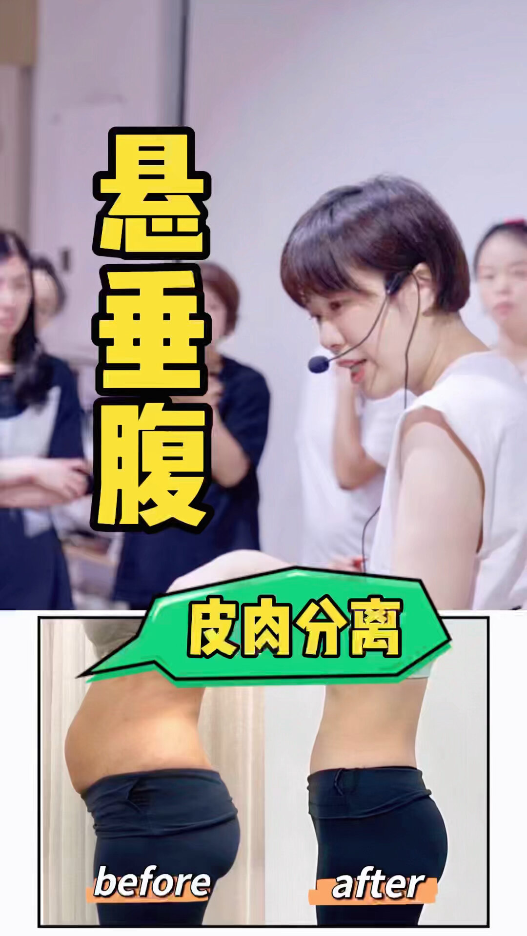 孕期悬垂腹,产后就会皮肉分离调整看这里!