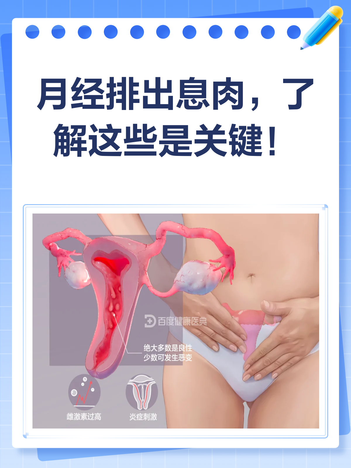 月经排出息肉？别慌，先了解这些