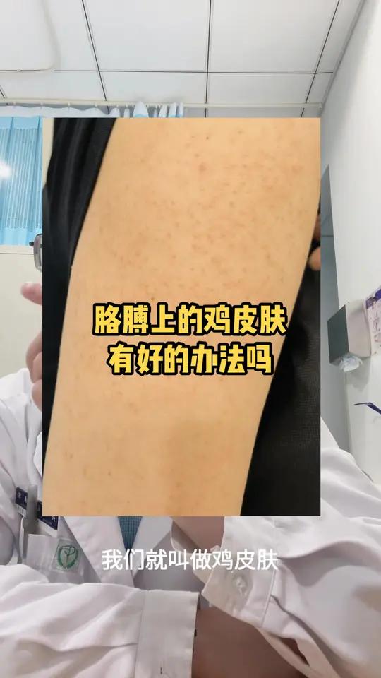 胳膊上的鸡皮肤,持续好多年,也没有根治的办法