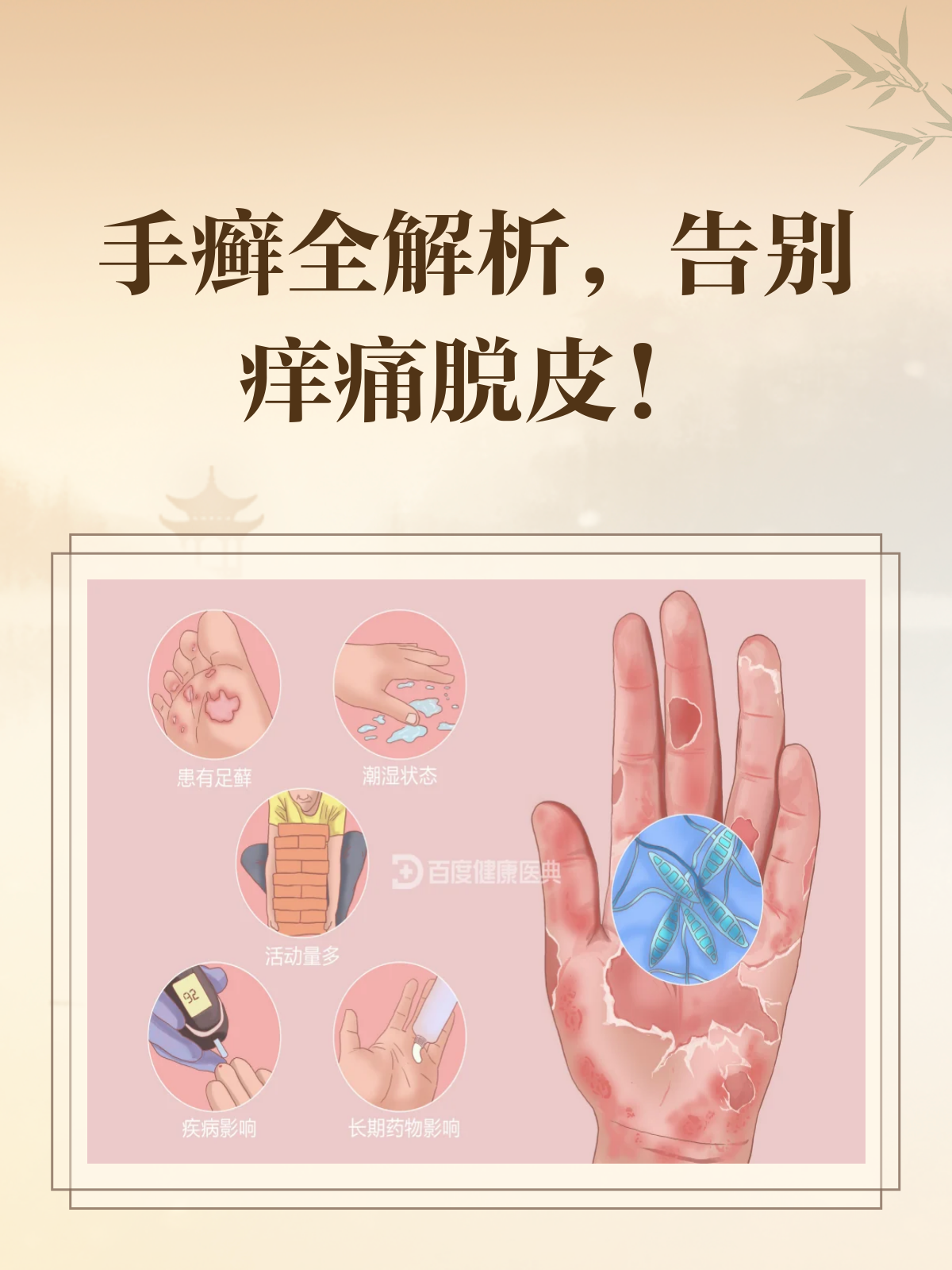 手癣来袭,你的“第二张脸”还好吗?