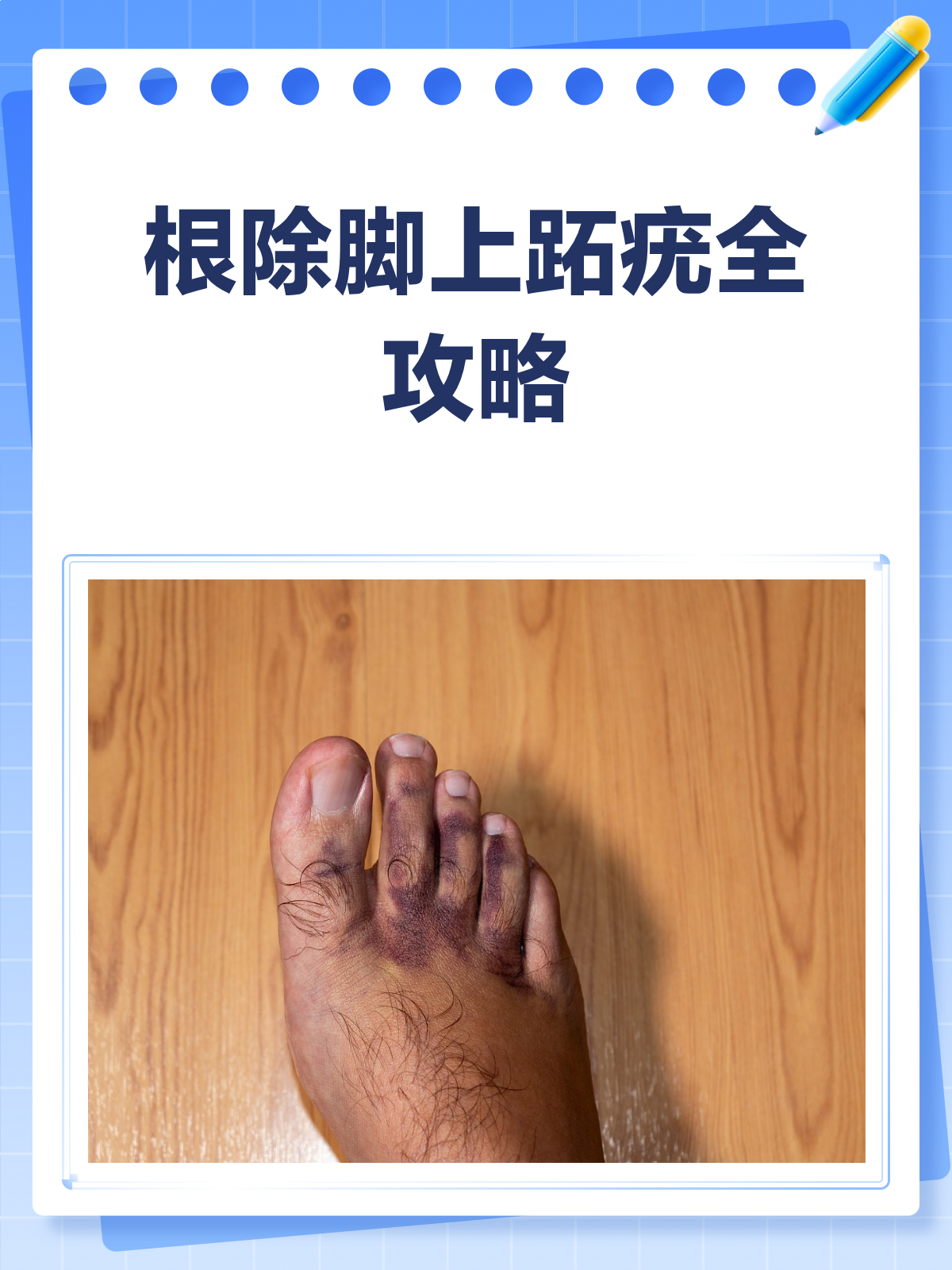 脚上跖疣,告别烦恼有妙招!